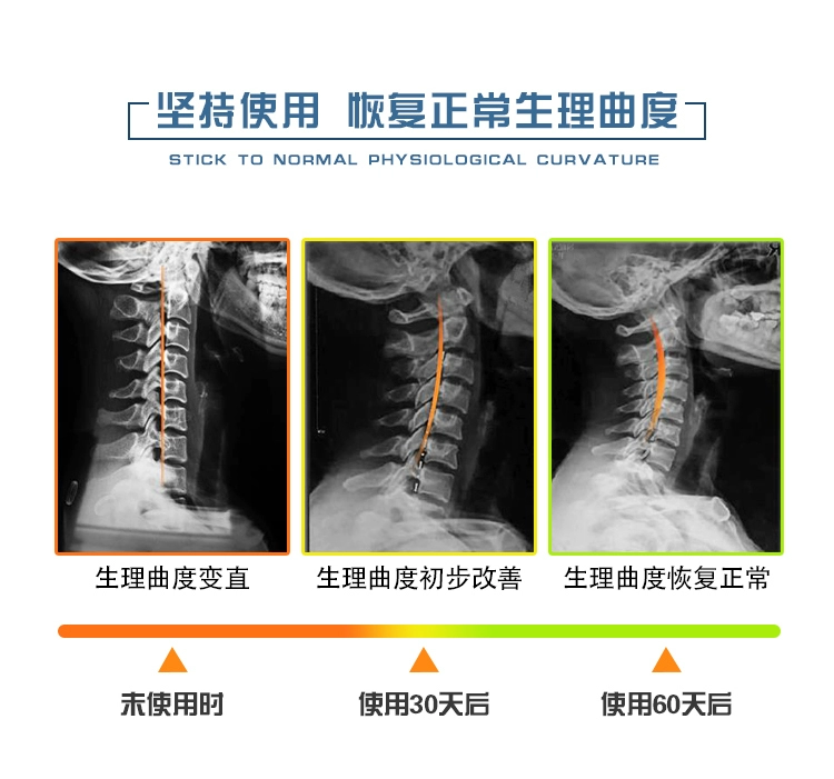 Buckwheat điều dưỡng gối cổ tử cung sửa chữa cột sống cổ tử cung đặc biệt gối ngủ vật lý trị liệu kéo gối - Gối