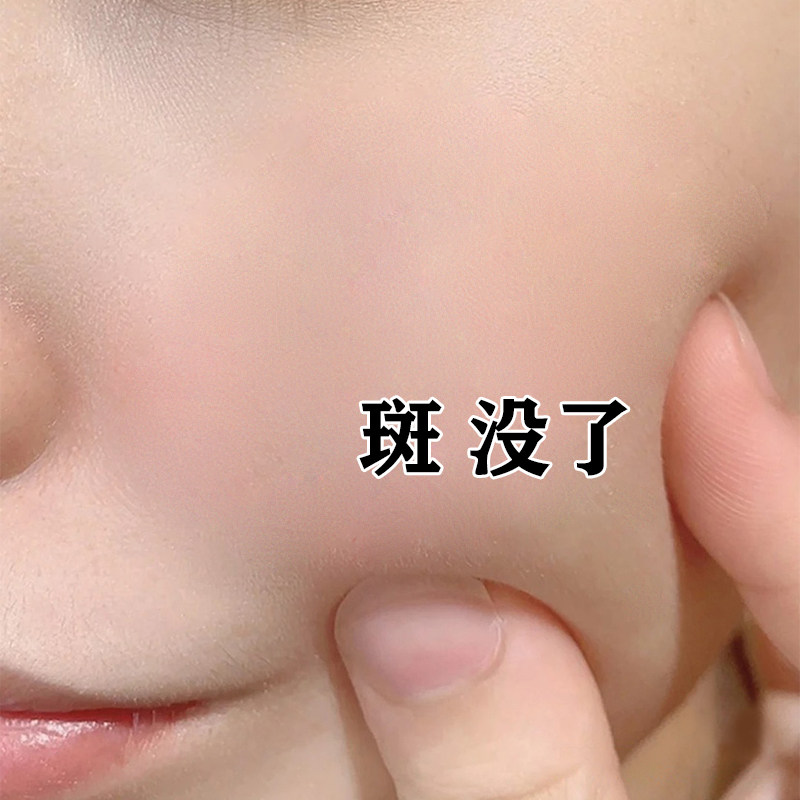 (Recommended by Via)Dilute the black spots on the face Sunrise Allure whitening blemish liquid beauty salon special