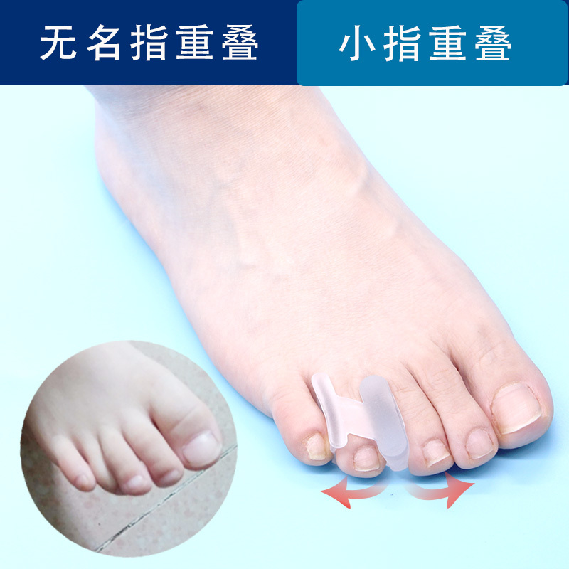 Adult Fourth Toe Ring Finger Toe Separator for Daily Use, Side Bending, Overlapping, Deformation, Wide Shoes, Can Walk
