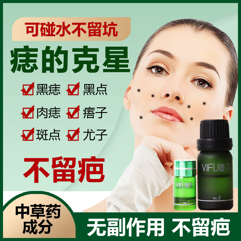 Weifu Mole Removal Mole Cream No Trace Water Home Mole Removal Artifact Spot Warts Black Spot Repair Water Instrument