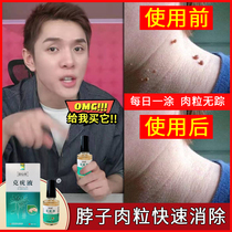 Go to the small meat wart on the neck.