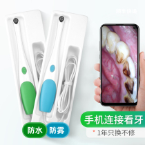 Mobile oral dental endoscope high-definition camera observer home nursing medical examination mirror dental viewing mirror
