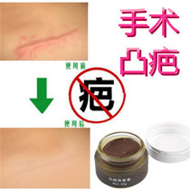 Surgery to repair hypertrophic keloids remove uterine rupture scars Yinling laser stitches scratches and falls