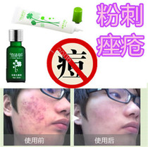 Closed whitehead acne immediate elimination chest acne flat liquid back bean rosacea grease granular cream