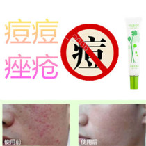 Remove facial acne and acne scars for men and women repair closed acne scars remove acne on chest back forehead and rosacea products