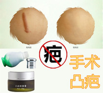 Eliminate convex pimples repair hypertrophic surgery cesarean section remove scars seal tattoos stitches and fall injuries