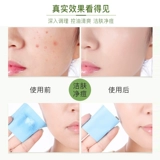 Ватные диски с салициловой кислотой от черных точек, анти-акне, скрывает прыщи, сужает поры