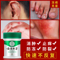 dong chuang gao zhi gen antipruritic frostbite swelling Frost crack flagship store frozen hand children face ears cream