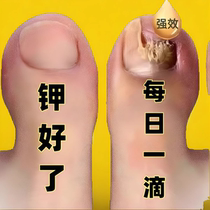 (Tongrentang Hot Sell) No pain for new potassium to enjoy a good A life Bad A to get a good jia drop a drop