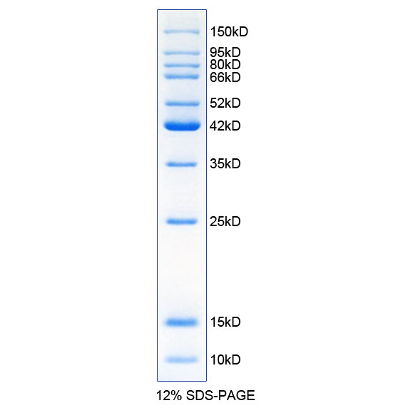 Protein Molecular Weight Standard (10-150Kd, Non-Pre-Stained) P0060S P0060M Biogenetech Protein Molecular Weight Standard (10-150Kd, Non-Pre-Stained) P0060S P0060M Biogenetech