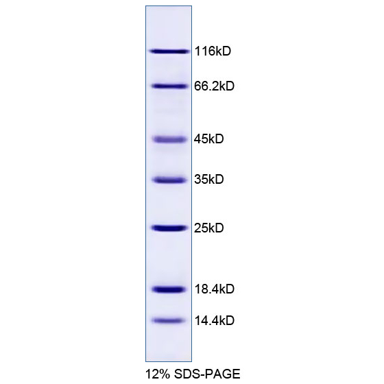 Protein Molecular Weight Standards (14.4-116Kd, Non-Pre-Stained) Protein Markers P0061 P0062 Protein Molecular Weight Standards (14.4-116Kd, Non-Pre-Stained) Protein Markers P0061 P0062