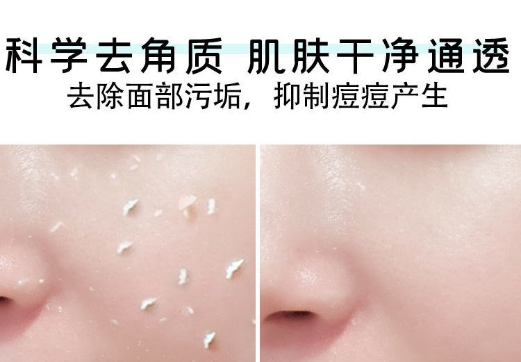 Old Bodhi Quốc gia Vẻ đẹp Lingfu Snowgrass 全体 Face Mild To Dead Gel tẩy tế bào chết cure