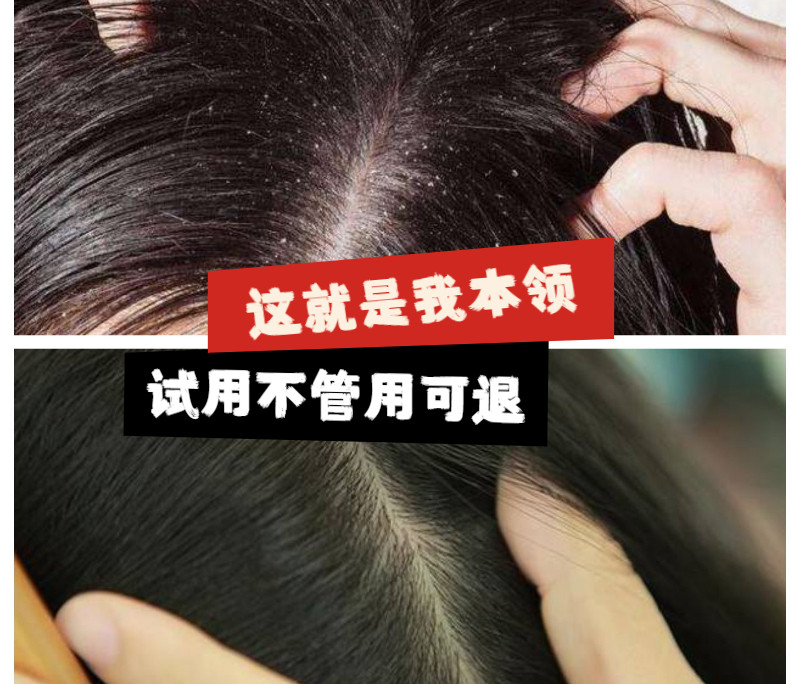 解决头皮屑烦恼,你值得拥有 百草堂去皮屑去痒洗发水正品 草药去头皮屑头痒控油护发素套大瓶 🧴 -头发护理-淘宝好物网