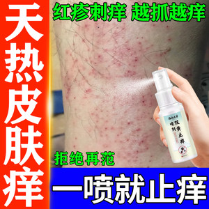 Yunnan Herbal Double Yellow Anti-Itch Spray for Dry and Itchy Skin, Whole Body, Sweaty and Itchy Calves, External Antibacterial Spray