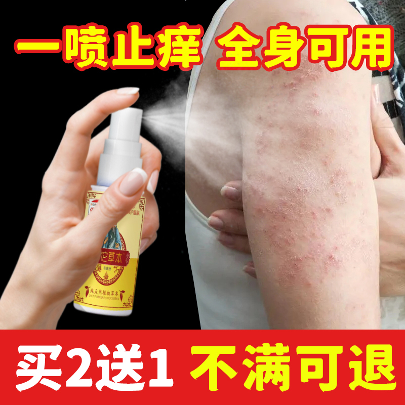 Anti-Itch Spray for Dry and Itchy Skin on the Body, External Use for Itchy Calves, External Use Spray for Hot Weather and Sweating Anti-Itch Spray for Dry and Itchy Skin on the Body, External Use for Itchy Calves, External Use Spray for Hot Weather and Sweating