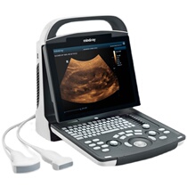 DP - 20 black and white B ultra - portable ultra - black and white ultra - portable ultrasound diagnostic system hand - in - hand B ultrasound