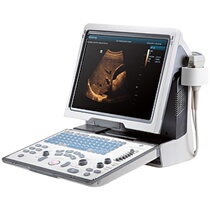 Myrie DP - 50 new portable black and white ultra - hand laptop ultrasound dual probe interface ultrasound diagnosis