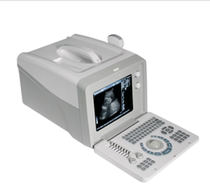 SS - 5B ultra - diagnostic instrument portable B ultrasonic black and white ultrasound ultrasound diagnostic instrument