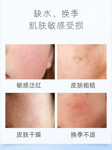 Восстанавливающий лосьон, успокаивающий увлажняющий комплект для чувствительной кожи для ухода за кожей