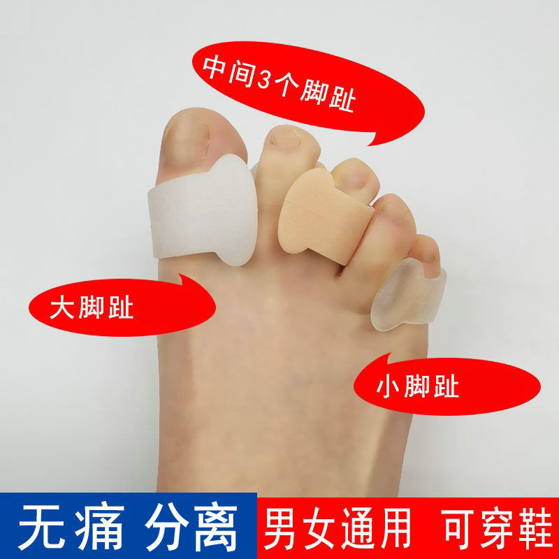 Overlapping Toe Separator, Toe Valgus Separator, Big Toe Shoe Protection, Anti-Wear Corn Separator, Toe Separation Silicone Protector