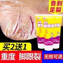 Heavy heel crack fissure and moisturizing cream and cream crack after the foot crack and the heel to peel the skin to crack