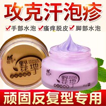 Up the fingers with little blistering dry hands cream paste arm itching stubble scalp feet peeling hand plaster