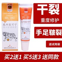 Crack hands and feet crack softens the cornea cream cream cream hands and feet peeling hands and feet crack