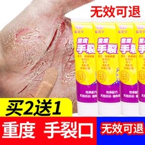 Hand crack hands and feet crack cream crack moisturizing men skirting women opening crack crack cream