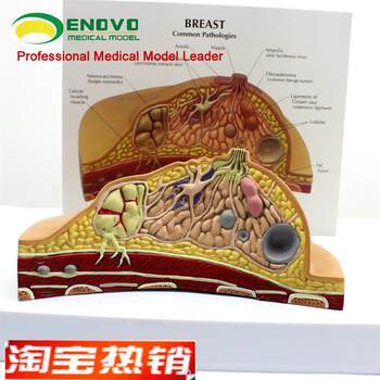 Yino genuine breast pathological anatomy model breast model obstetrics and gynecology teaching w nursing breast model