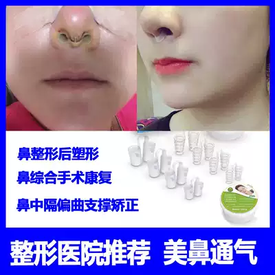 After rhinoplasty and plastic surgery, supporting fixed nasal column rib distortion anti-hyperplasia nasal septum deviation correction appliance