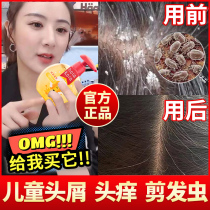 Childrens shampoo for girls Anti-dandruff and anti-itching shampoo for girls Baby official flagship store 6-12 years old