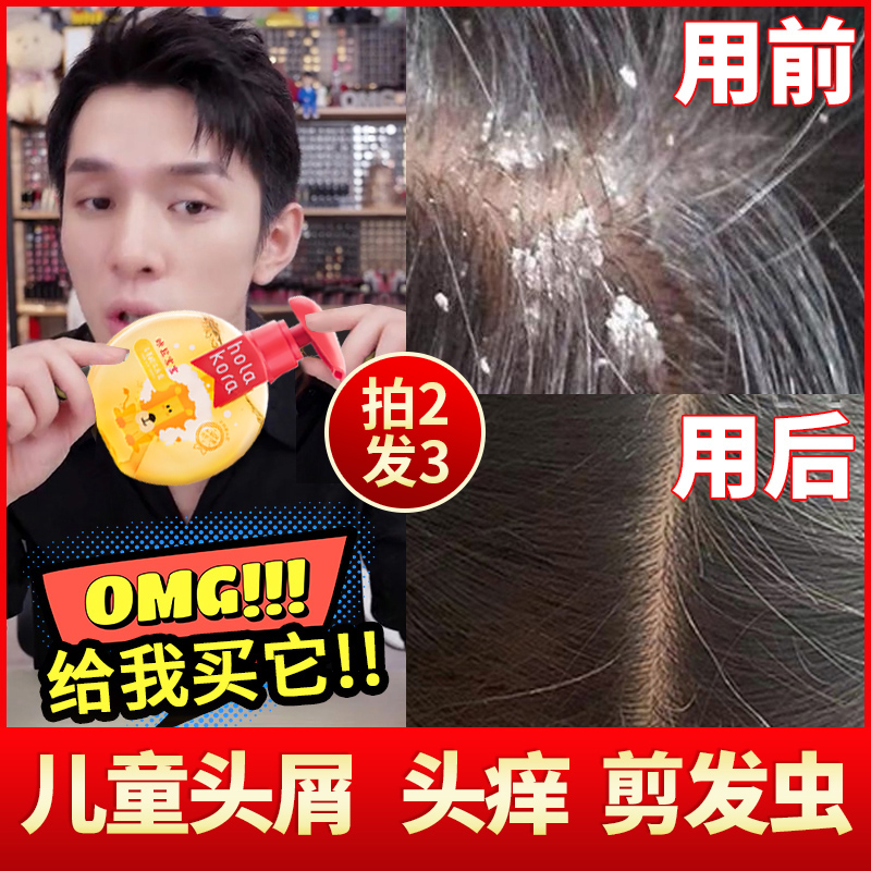 Children's Shampoo Flagship Store Shampoo Special for Girls Children Anti-dandruff and Anti-itch Baby Hair Cutting Worm 6-12 Years Old