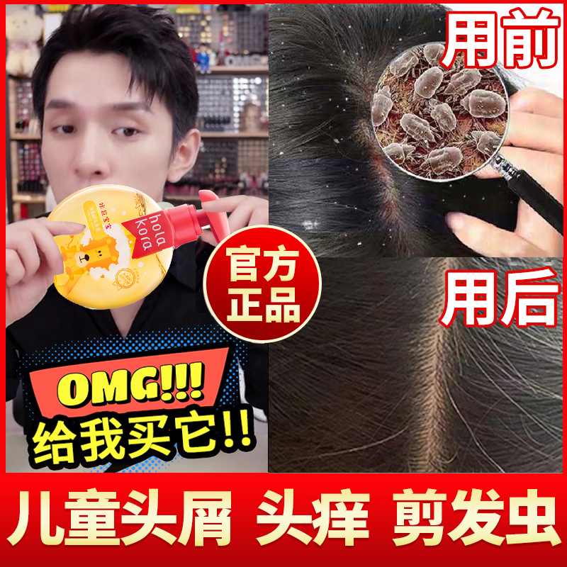 Children Shampoo Special Girl Boy Goes to Scrap Itchy Cut Hair Worm Baby Official Flagship Store 6-12 years old
