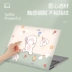 Thích hợp cho máy tính xách tay Huawei Matebook 14 vỏ film 2020 phiên bản mới Ruilong x pro vỏ bảo vệ d13 / 14 tùy chỉnh silicone nhẹ và phụ kiện miếng dán mỏng có thể được thích - Phụ kiện máy tính xách tay