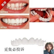 Denture teeth missing teeth temporary braces to cover net red defects disposable denture patches new tooth hole whitening