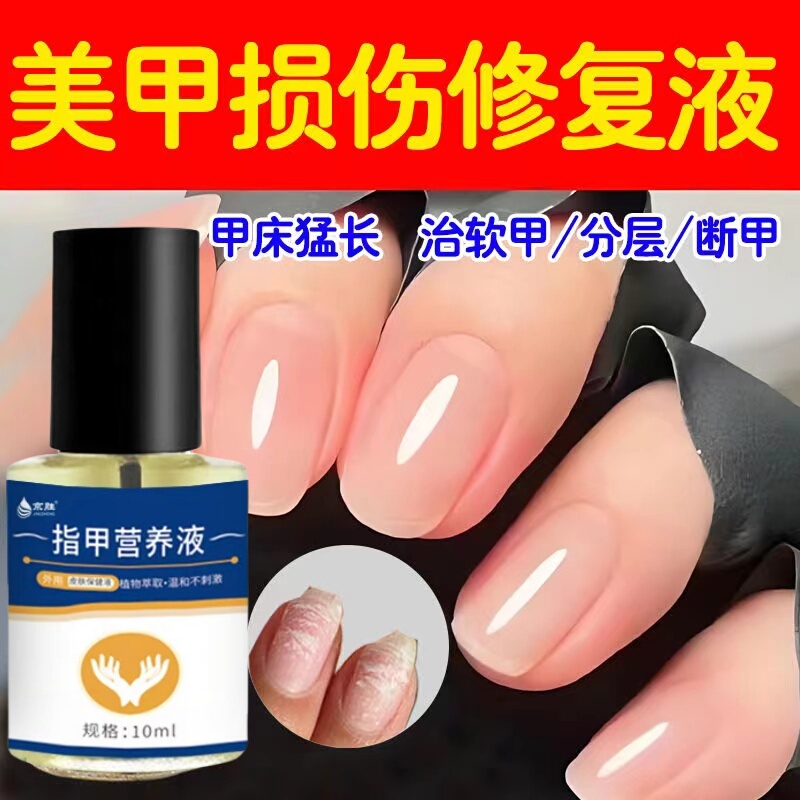 Nail Nutrition Oil, Manicure Special Nail Nutrient Solution Oil, Nail Oil, Anti-Hangnail, Anti-Breakage, Thickening Care Solution