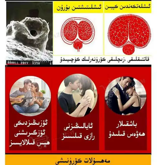 Увеличение плазм لوحة?