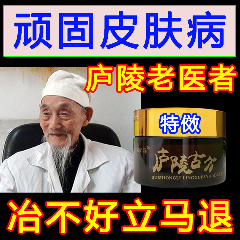 Cow Leather External Skin Special Treatment Allergy Pruritus Urticaria Femoral Ringworm root Eczema Stop Itch to Root Cream