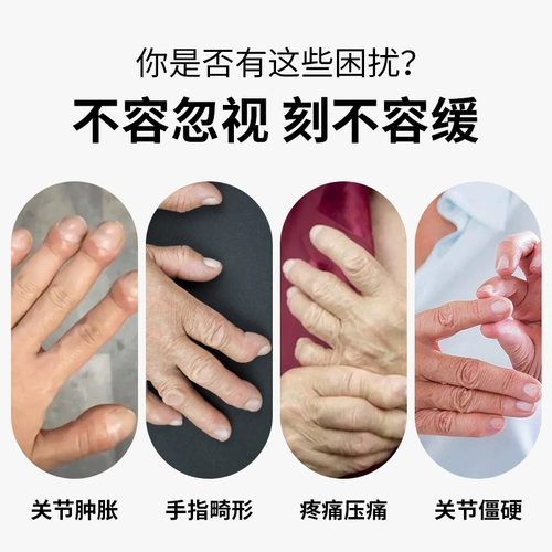 Ревматоидный артрит, боль в перчатках, болезненность, деформация и отек пальцев, специализированная физиотерапия, электронагревательный компрессионный инструмент для лечения теносиновита