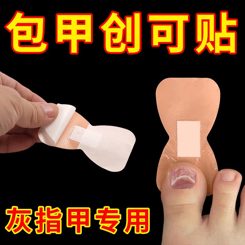 New Band-Aid for Onychomycosis, Nail Cover for Fingertips, Nail Cap for Toes, Medication Application, Protective Cover to Prevent Foot Abrasion