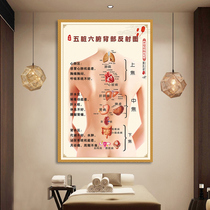 Beauty Salon Back Meridians Dredging Publicity Painting Traditional Chinese Medicine Health Preservation Gallery Decoration Painting Posters Wall Chart Cupping Scraping Wall Sticker