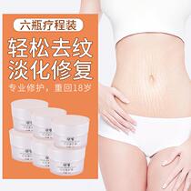 6 Bottled Japans Department of Gestational Tattoo Postpartum Repair Cream Pregnant pregnant woman Prevention of Hauchen Obesity removes the elimination of tights Mom