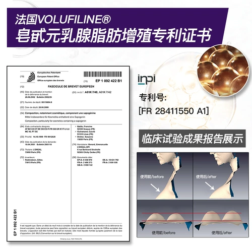 Крем, масло для здоровья груди, увеличивающие послеродовые наклейки на соски