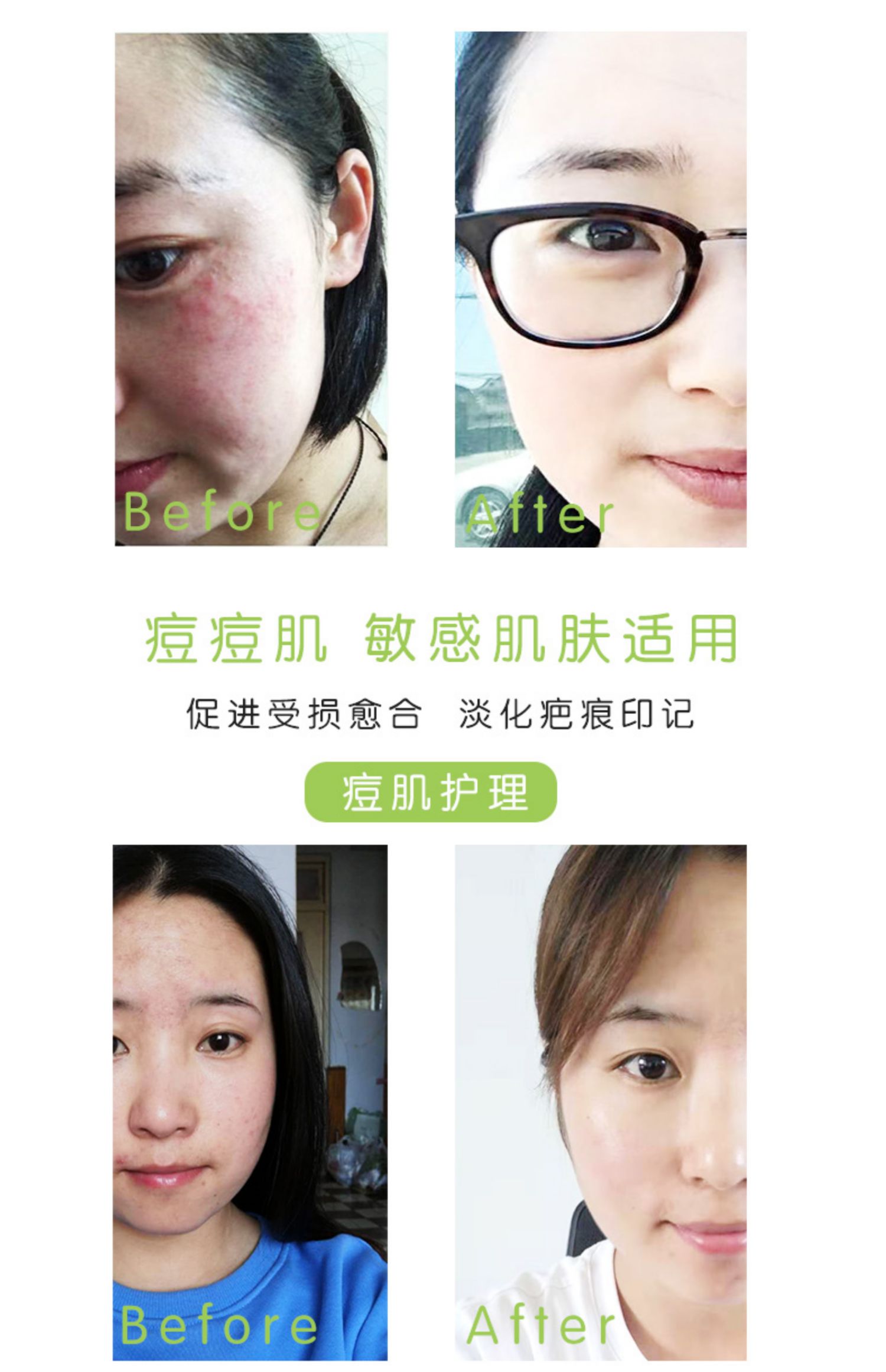 Yan Yan Barrier Repair Essence Oil Oil Lotion Sensitive Muscle Cream Replenishing Water Locking Water Freshing Moisturising Summer Summer - Kem dưỡng da kem dưỡng ẩm cho da mặt khô