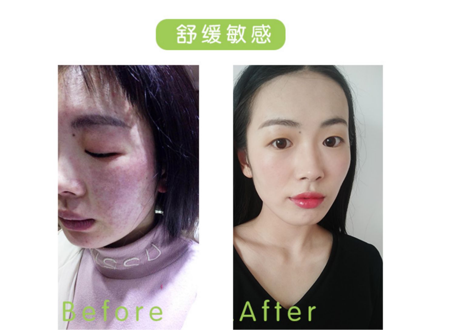 Yan Yan Barrier Repair Essence Oil Oil Lotion Sensitive Muscle Cream Replenishing Water Locking Water Freshing Moisturising Summer Summer - Kem dưỡng da kem dưỡng ẩm cho da mặt khô