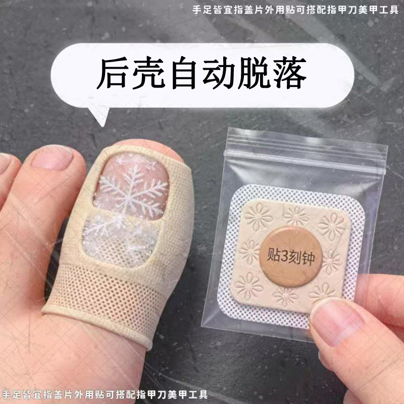 【Hot-Selling Chinese Medicine Product】Specialized Nail Removal Patches with Plant Extracts, Genuine Product, Suitable for Toes, Fingers, and Fingernails