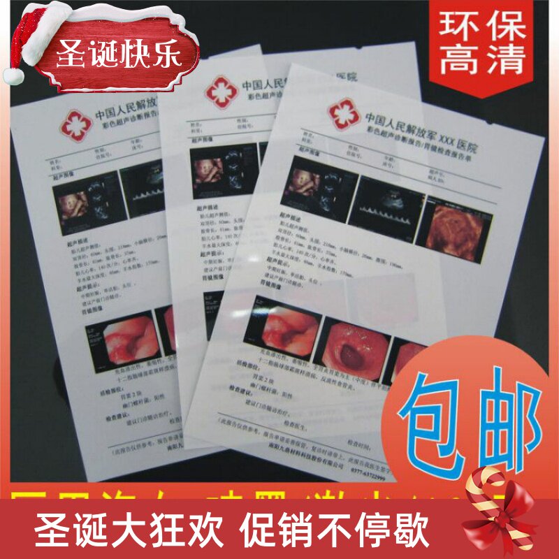 Hospital negatives porcelain white inkjet film negatives A4 negatives Gastroscopy B ultrasound four-dimensional color ultrasound 100 sheets