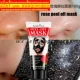 rose peel off mask
