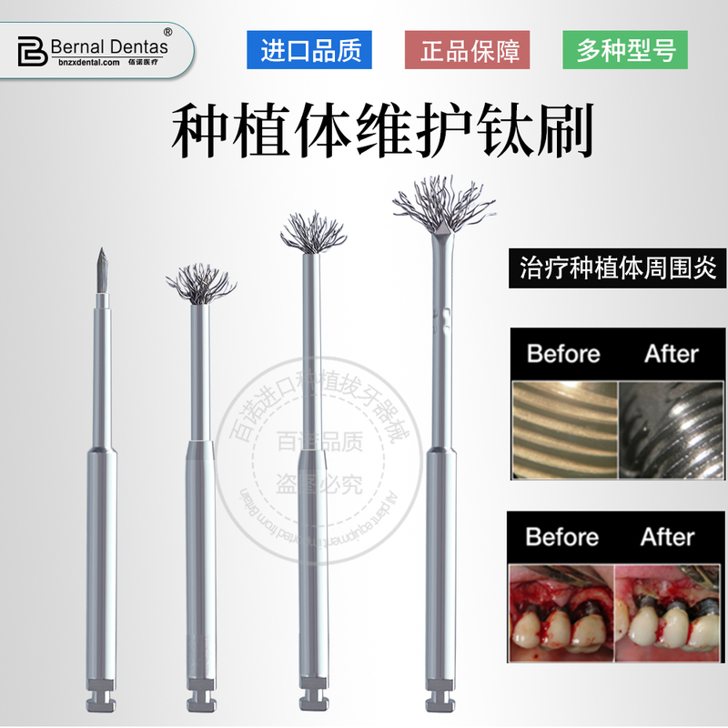 Bainuo Imported Titanium Brush for Dental Implant Maintenance, Cleaning Implant Restoration Titanium Brush, Abutment Denture Brush