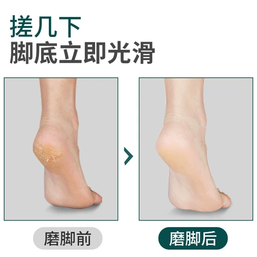 Артефакт -сшивающий ног, чтобы удалить мертвую кожу, называющую домом с обеими сторонами, и потирая ноги, размолотые камень, чтобы восстановить подошвы кожи ног и втирать инструмент каблука